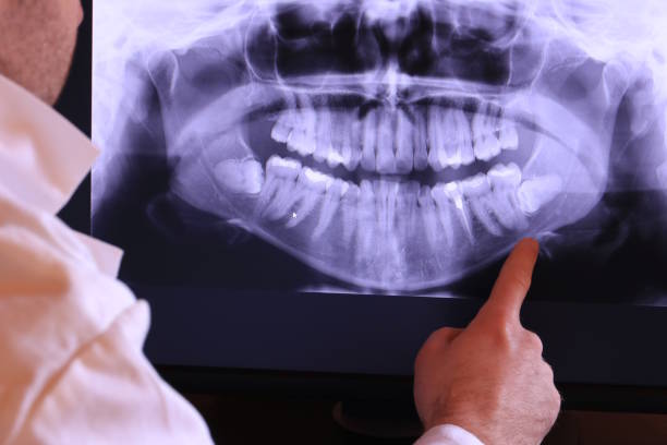 Best Dental Abscess Treatment in Lakefield, MN